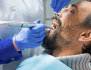 a man having his teeth cleaned by a dental hygienist