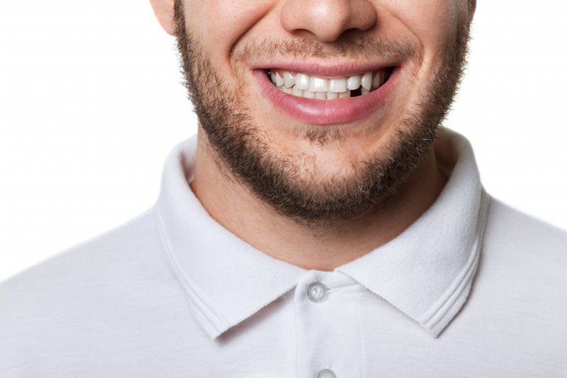 man missing a tooth