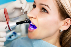 Close up of dentist preparing to whiten a woman’s teeth